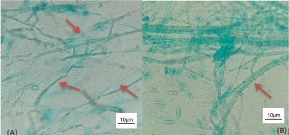 Hình 3 17 Hệ sợi nấm Fusarium dưới tác động của dịch nuôi cấy vi khuẩn 2
