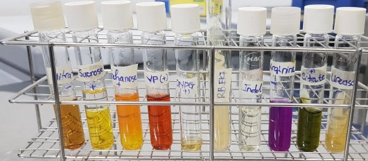 Hình 5 Ảnh hưởng của thời gian nhân giống và lên men đến mật độ chủng 7