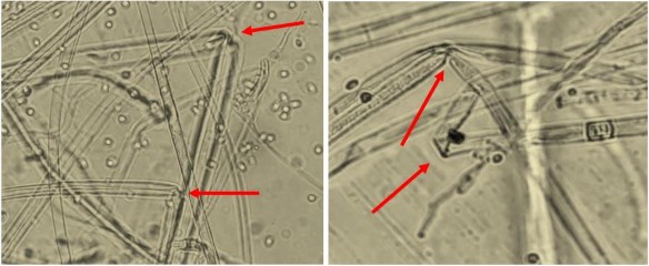 Hình 17 Sợi Phytophthora bị gãy gập xoắn ở phần tiếp giáp với đĩa giấy 3