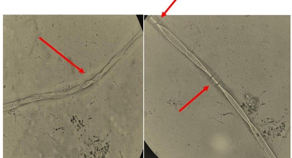 Hình 18 Sợi Phytophthora bị xoắn ở phần tiếp giáp với đĩa giấy chứa hợp 4