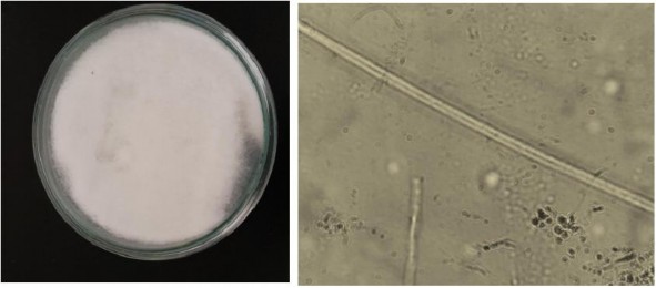 Hình 19 Nấm Phtophthora và hệ sợi ở đĩa đối chứng Hình 20 Hệ sợi nấm 5