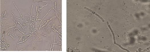 Hình 20 Hệ sợi nấm Fusarium bị đứt gãy Hình 21 Trứng tuyến trùng bị tác 6