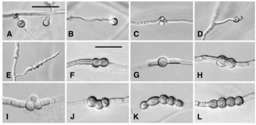 Hình 1 2 Bào tử hậu của các loài Fusarium 45 50 A B Bào tử hậu đơn như 1