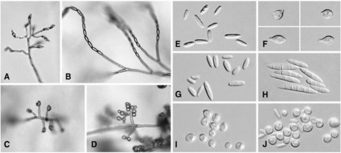 Hình 1 4 Sự hình thành và các loại bào tử đính nhỏ do các loài Fusarium tạo ra 3