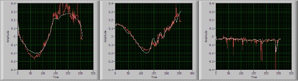 a H 1X b H 1Y c H 1Z Hình 4 26 Kết quả lọc MS AUKF các thành phần VTT khi nhiễu 10