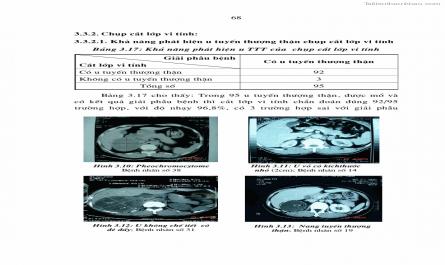 Luận án tiến sĩ y học Nghiên cứu chẩn đoán và điều trị phẫu thuật nội soi các u tuyến thượng thận lành tính tại bệnh viện Việt Đức giai đoạn 1998 - 2005 - 14