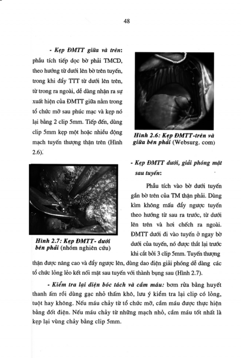 Nghiên cứu chẩn đoán và điều trị phẫu thuật nội soi các u tuyến thượng thận lành tính tại bệnh viện Việt Đức giai đoạn 1998 2005 8 3