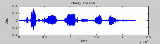 Hình 4 13 Dạng sóng của tín hiệu bị nhiễu do người nói xung quanh với SNR 16