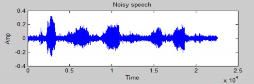 5dB Hình 4 7 Dạng sóng của tín hiệu bị nhiễu do người nói xung quanh với SNR 4