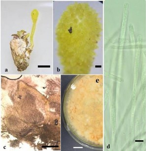 Hình 3 8 Hình thái mẫu CPA31 a Trạng thái ngoài tự nhiên b Phần stroma c Quả 4