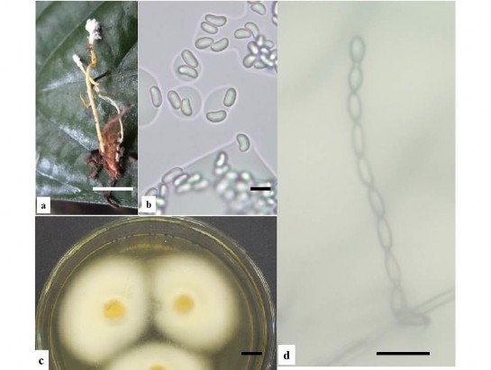 Hình 3 9 Hình thái mẫu CPA40 a Trạng thái ngoài tự nhiên b d Bào tử c Khuẩn 5