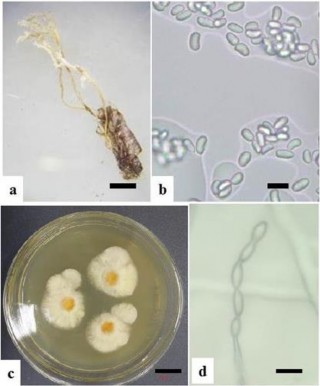 Hình 3 12 Hình thái mẫu XS07 a Trạng thái ngoài tự nhiên b d Bào tử c Khuẩn 7