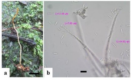 Hình 3 13 Hình thái mẫu XS12 a Trạng thái ngoài tự nhiên b Túi bào tử Scale 8