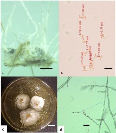 Hình 3 20 Hình thái mẫu XS67 a Trạng thái ngoài tự nhiên b Bào tử c Khuẩn 7