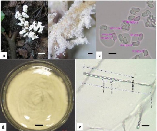 Hình 3 21 Hình thái mẫu XS69 a b Trạng thái ngoài tự nhiên c Bào tử d Hệ 8