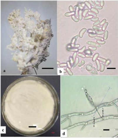 Hình 3 22 Hình thái mẫu XS71 a Trạng thái ngoài tự nhiên b Bào tử c Hệ sợi 1