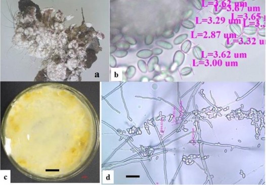 Hình 3 24 Hình thái mẫu XS83 a Trạng thái ngoài tự nhiên b Bào tử c Hệ sợi 3