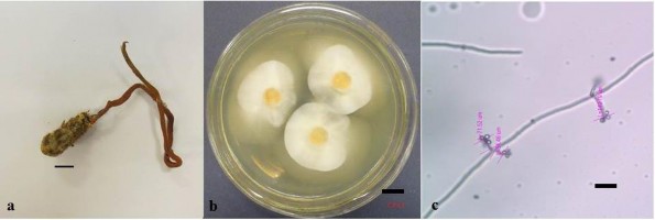 Hình 3 2 Hình thái mẫu CPA3 a Phần stroma b Khuẩn lạc nuôi cấy trên môi 3