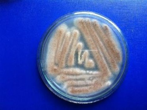 Hình 3 1 Chủng nấm sợi Aspergillus niger GA15 Hình 3 2 Kiểm tra hoạt tính enzyme 3