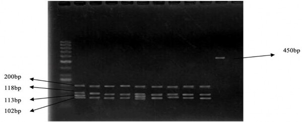 Hình 3 3A Đa hình đoạn gen POU1F1 của dê Định Hóa phân tích bằng enzyme Dde I 5