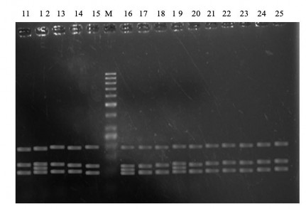 Hình 3 3B Đa hình đoạn gen POU1F1 của dê Định Hóa phân tích bằng enzyme Dde I 6