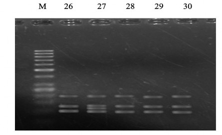 Giếng M ADN thang chuẩn kích thước 50 bp Giếng 11 25 sản phẩm cắt exon 6 gen 7