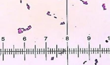 Phân Lập Và Định Danh Chủng Vi Khuẩn Lactobacillus