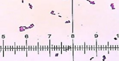 Hình 3 1 Hình dạng tế bào chủng vi khuẩn L6 dưới kính hiển vi quang học Hình 1