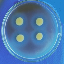 Thủy phân casein Thủy phân Tween 80 Thủy phân tinh bột 1 5 Hình ảnh mẫu cây giao 16