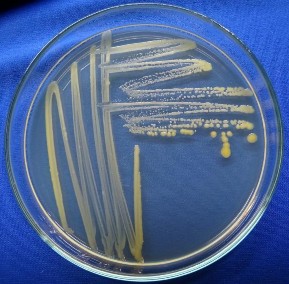 Phân lập mẫu Ria làm thuần mẫu 1 3 Hình ảnh chủng bệnh nhân tạo trong phòng 2