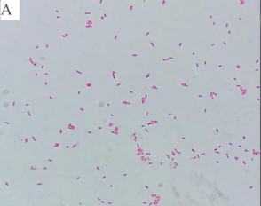 Nhuộm Gram Chụp SEM Thử nghiệm catalase Thử nghiệm oxidase Thử nghiệm KOH 3 Khả 6