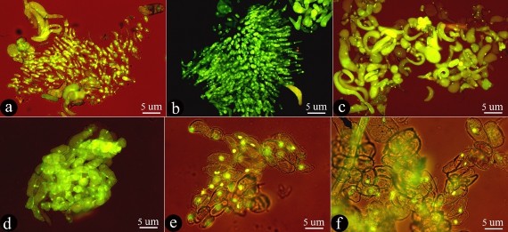 Hình 3 4 Huyền phù tế bào từ mô sẹo cây salem trong môi trường nuôi cấy lỏng 2