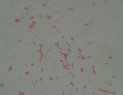 Khuẩn lạc tròn lồi nhầy màu trắng đục Tế bào hình que gram âm không di 10