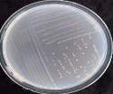 Khuẩn lạc màu trắng trong Tế bào hình que gram dương sinh bào tử di động 15