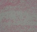 Khuẩn lạc tròn lồi nhầy màu trắng đục Tế bào hình que gram âm không di 19
