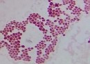 Đại thể Khuẩn lạc tròn lồi nhầy màu vàng Vi thể tế bào hình cầu gram 2