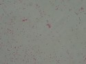 Khuẩn lạc tròn lồi nhầy màu trắng trong Tế bào hình que gram âm không di 23
