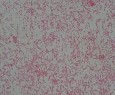 Khuẩn lạc tròn lồi nhầy màu vàng đục Tế bào hình que gram âm không đi 6