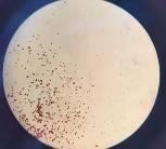 e f a Mẫu giống GL3 b bao phấn khi thu c bao phấn sau khi bung d hạt 17