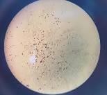 e f a Mẫu giống GL1 b bao phấn khi thu c bao phấn sau khi bung d hạt 5