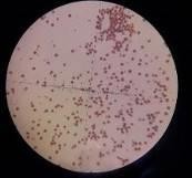 Ban đầu 5 ngày 15 ngày 25 ngày 35 ngày 45 ngày Hình 4 12 Độ hữu dục của hạt 13