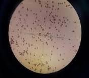 Ban đầu 5 ngày 15 ngày 25 ngày 35 ngày 45 ngày Hình 4 12 Độ hữu dục của hạt 14