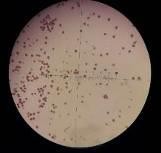 Ban đầu 5 ngày 15 ngày 25 ngày 35 ngày 45 ngày Hình 4 12 Độ hữu dục của hạt 15