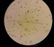 25 ngày 35 ngày 45 ngày Hình 4 12 Độ hữu dục của hạt phấn mẫu giống GL1 sau 16