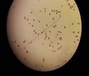 25 ngày 35 ngày 45 ngày Hình 4 12 Độ hữu dục của hạt phấn mẫu giống GL1 sau 17