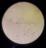 25 ngày 35 ngày 45 ngày Hình 4 12 Độ hữu dục của hạt phấn mẫu giống GL1 sau 18