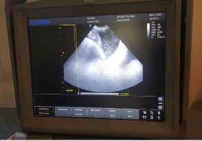 âm mới phát hiện được Bảy trường hợp chủ yếu phát hiện qua các triệu 1