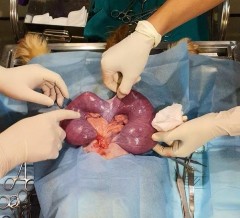 Phương pháp phẫu thuật ngoại khoa Hình ảnh bộc lộ tử cung bị viêm Tử cung 10