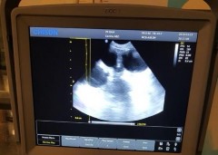 MỘT SỐ HÌNH ẢNH TRONG QUÁ TRÌNH TRIỂN KHAI ĐỀ TÀI Triệu chứng viêm tử cung 4