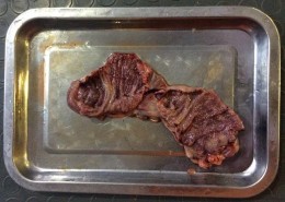 Phương pháp phẫu thuật ngoại khoa Hình ảnh bộc lộ tử cung bị viêm Tử cung 7